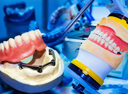 dentures being made at a dental lab