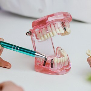 Dentist pointing to model of dental implant