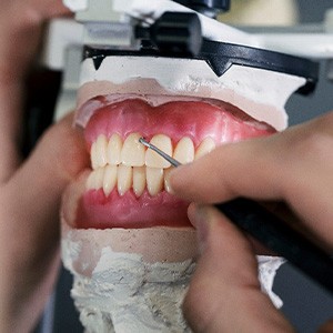 Dentures being created at a dental lab