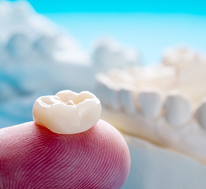 Closeup of a dental crown on a fingertip with model jaw in background