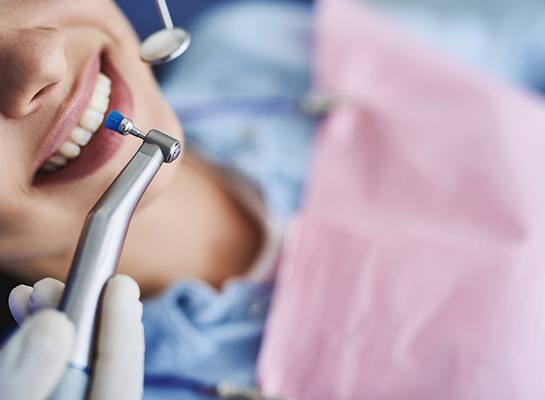 Closeup of dental brush about to polish patient’s teeth