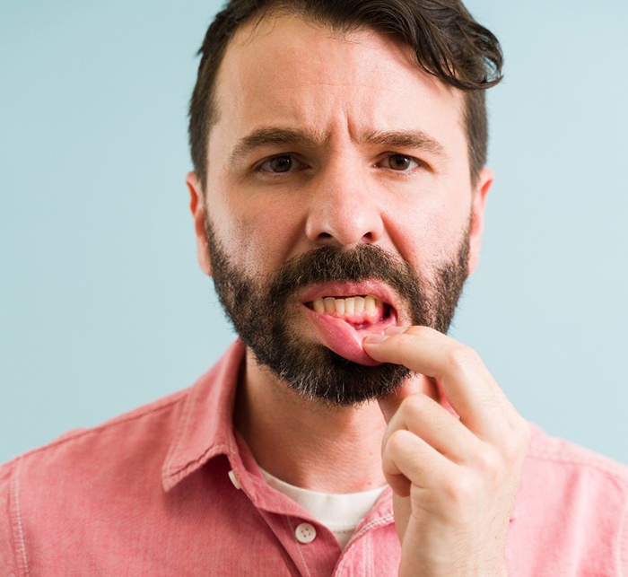 A man with gum disease