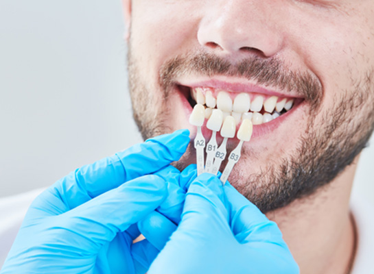 A dentist assessing a male patient for a smile makeover
