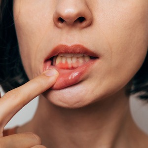 Woman with gum irritation