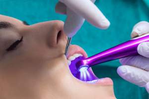 a patient is receiving dental sealants from her dentist