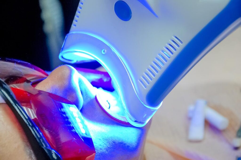 a patient receives teeth whitening services after asking their dentist is teeth whitening harmful